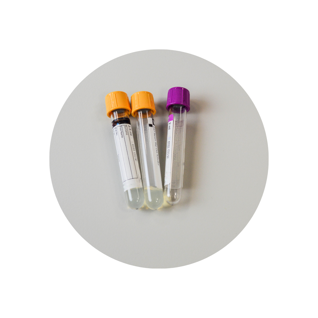 Lowering plasma S-adenosylhomocysteine (SAH) in healthy adults with elevated SAH and normal homocysteine using nutritional supplementation