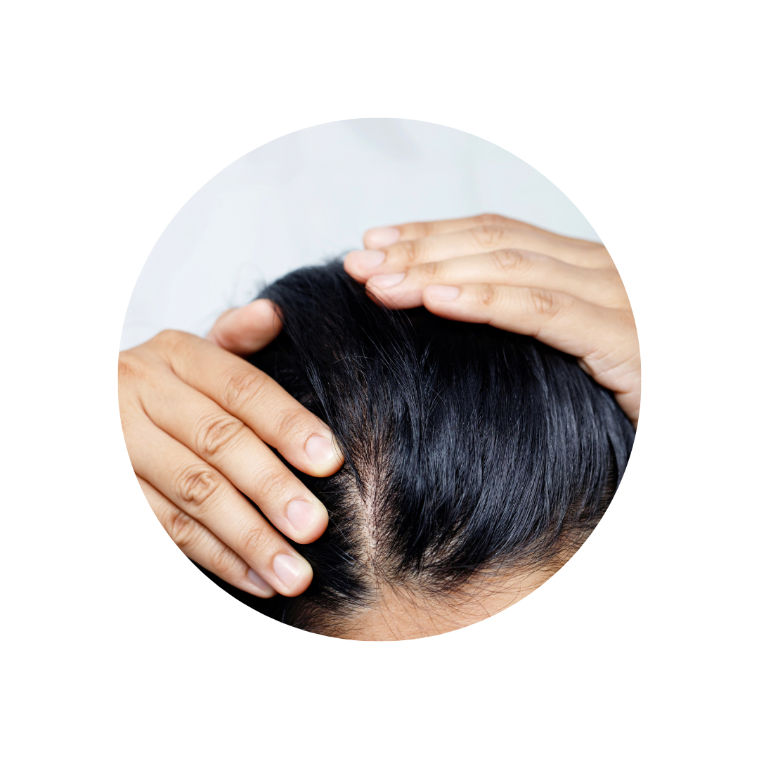 A Randomized Double-Blind Evaluation of a Novel Biotin and Silicon Ingredient Complex on the Hair and Skin of Healthy Women